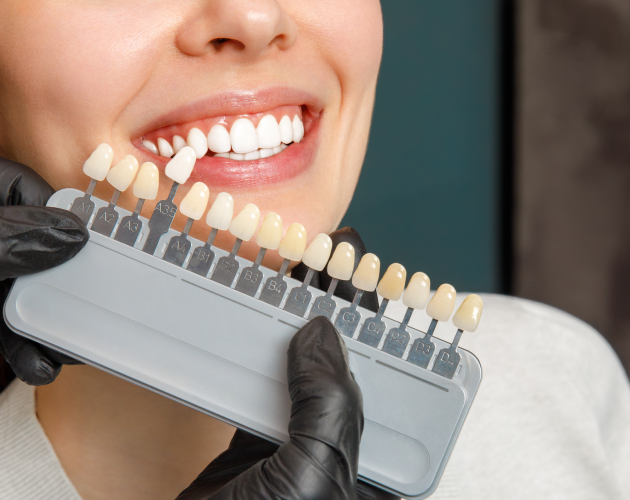 Dental professional holding tooth shade guide next to patient's smile for color matching.