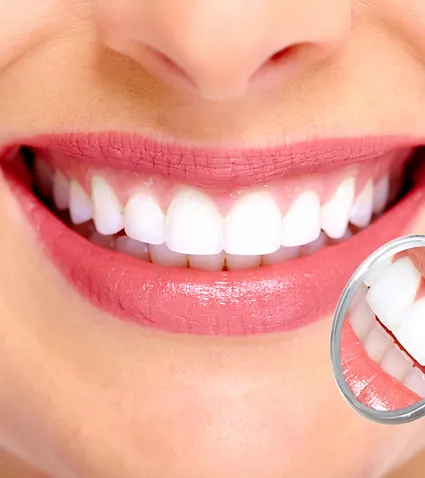 Close-up of woman's bright smile showing white teeth and pink lips with magnified detail inset.
