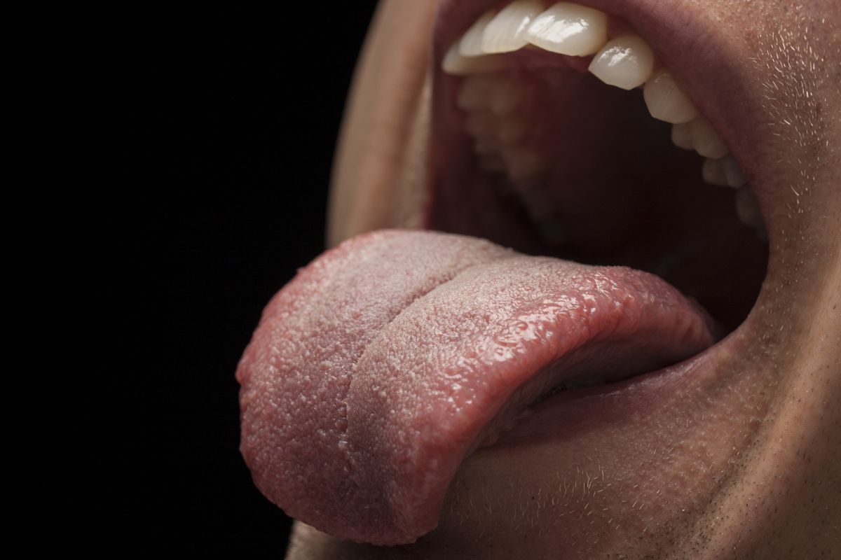 pain in tongue